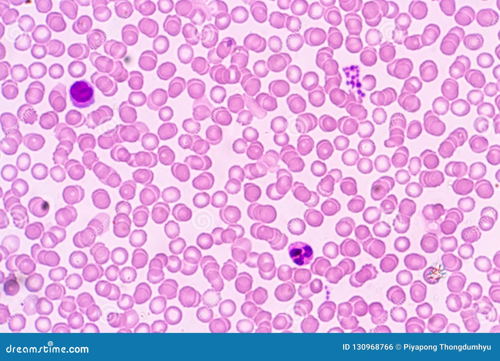 Immune cells under a microscope